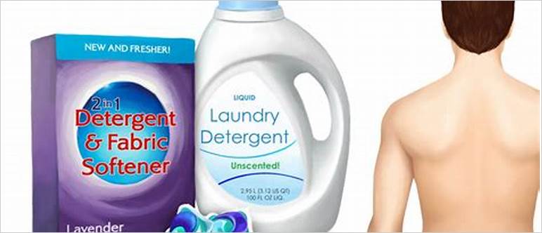 Can detergent cause acne